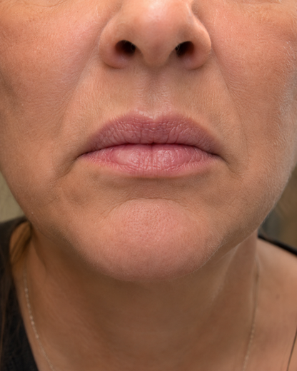 Your LipstickShouldn't MakeYou Look Older.